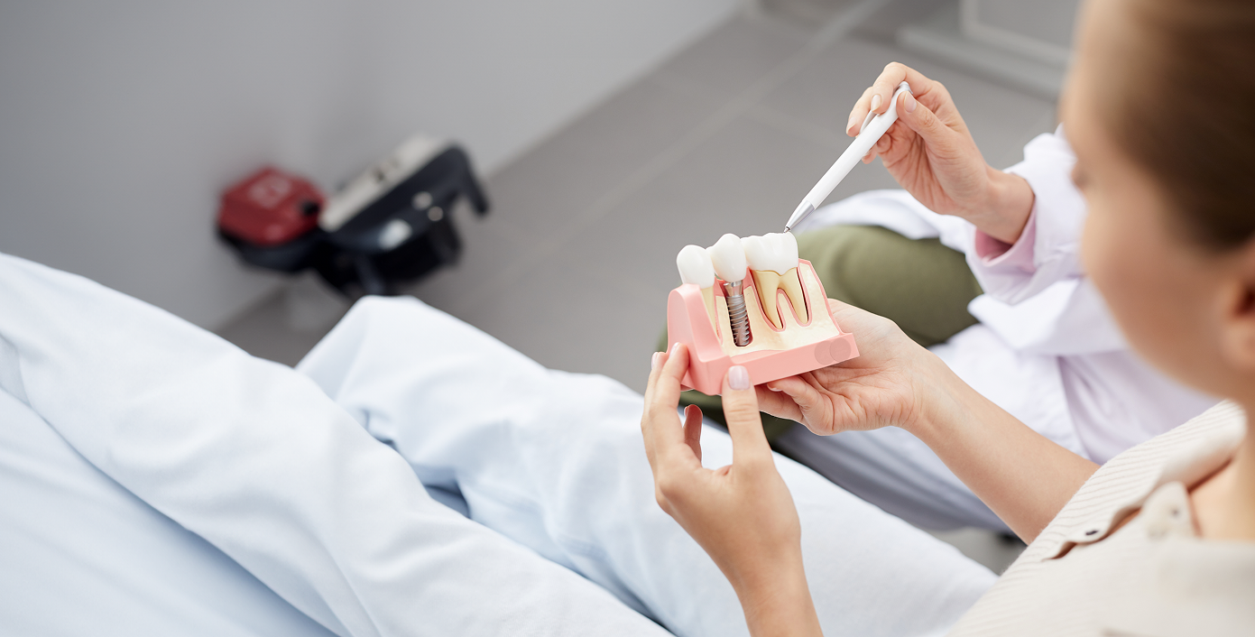 Dental Implants