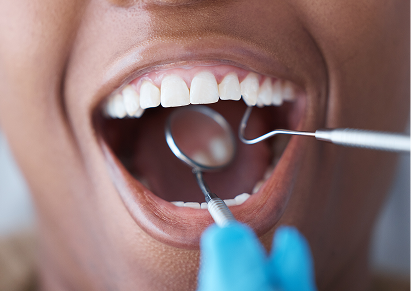 Routine Checkups & Fluoride Treatments