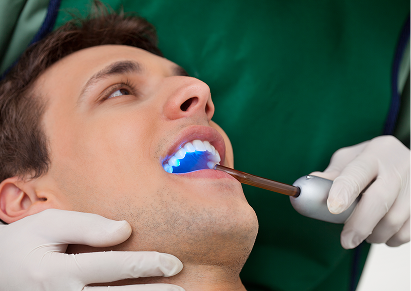 Dental Sealants