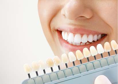 Minimal-Prep Veneers