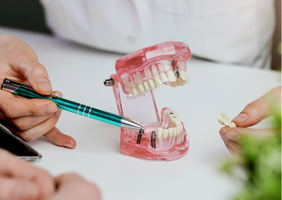 Single or Couple Tooth Replacement